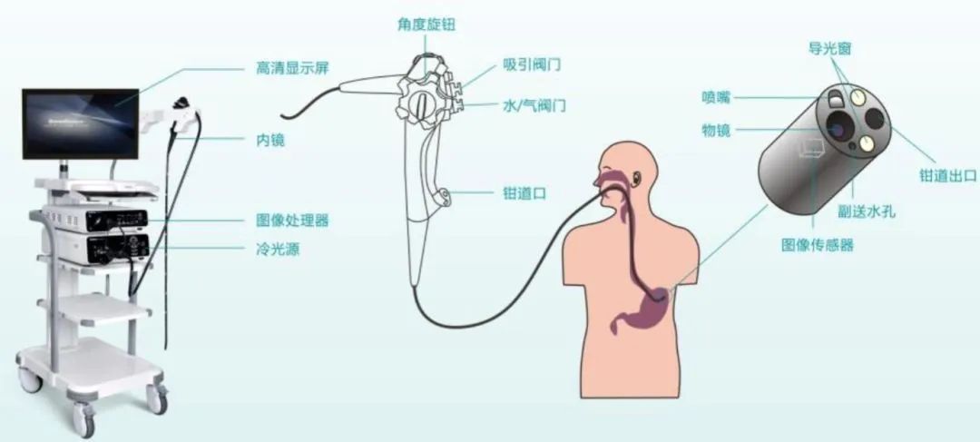 消化道,呼吸道等疾病的发病率不断提高,内窥镜检查的需求也越来越多